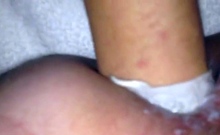 Punished British Anal Fisting